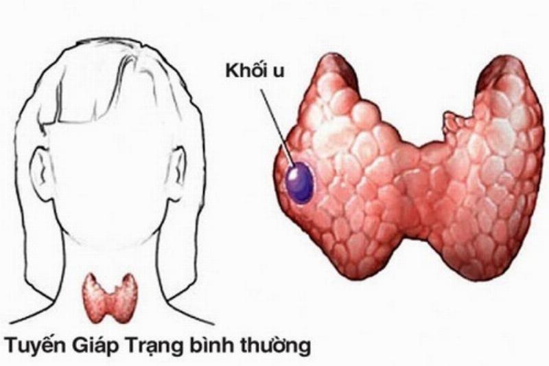 Chế Độ Ăn Uống Và Luyện Tập Cho Tuổi Giáp Tý