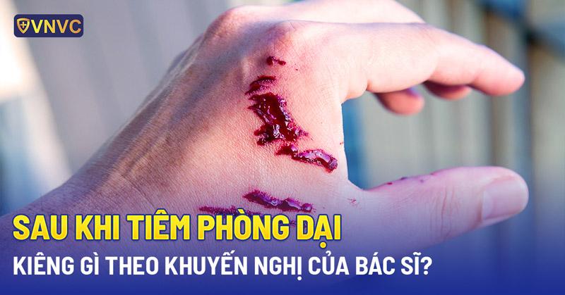 Điều Cần Tránh Khi Xin Xăm